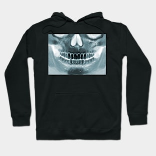 Killer Masks - Skull X-Ray Hoodie